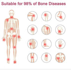 Perfectx Joint and Bone Treatment Cream (Buy 1 Get 1 Free)
